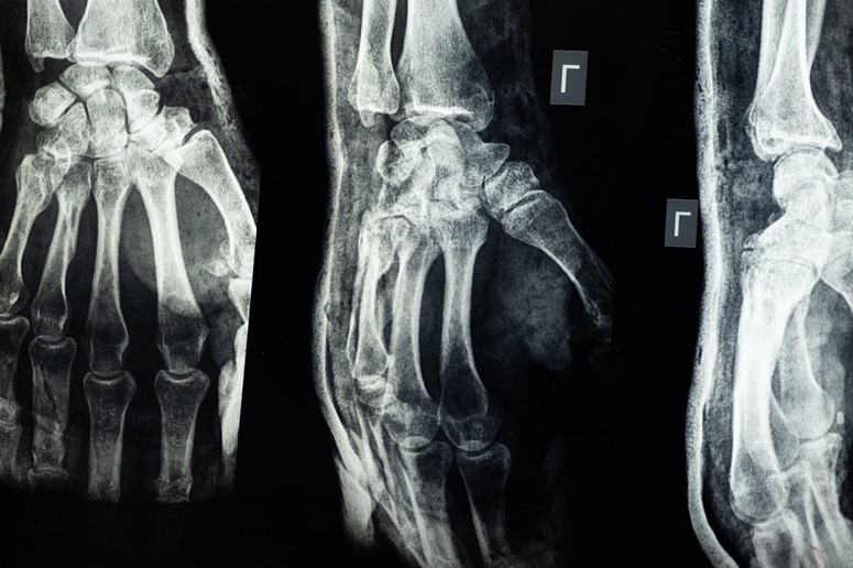 Photos of an x-ray